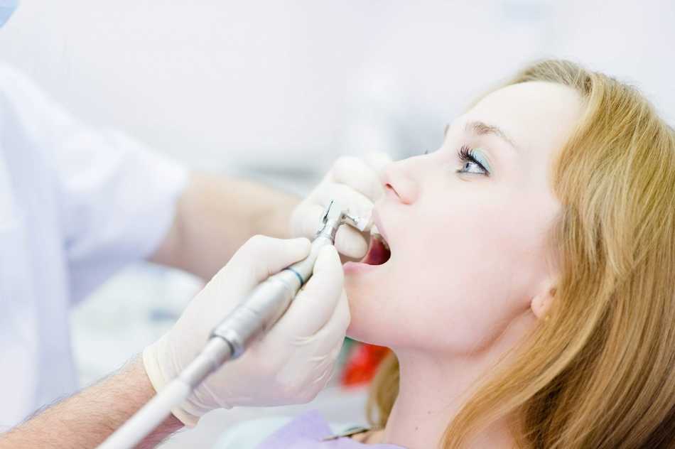 профессиональная процедура отбеливания зубов